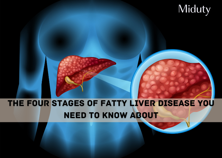 The Four Stages Of Fatty Liver Disease You Need To Know About