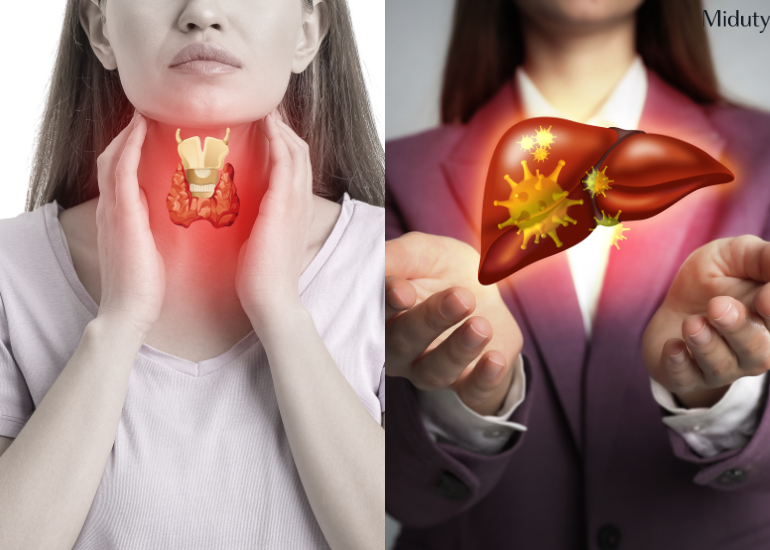 The Link Between Hypothyroidism and Non Alcoholic Fatty Liver Disease