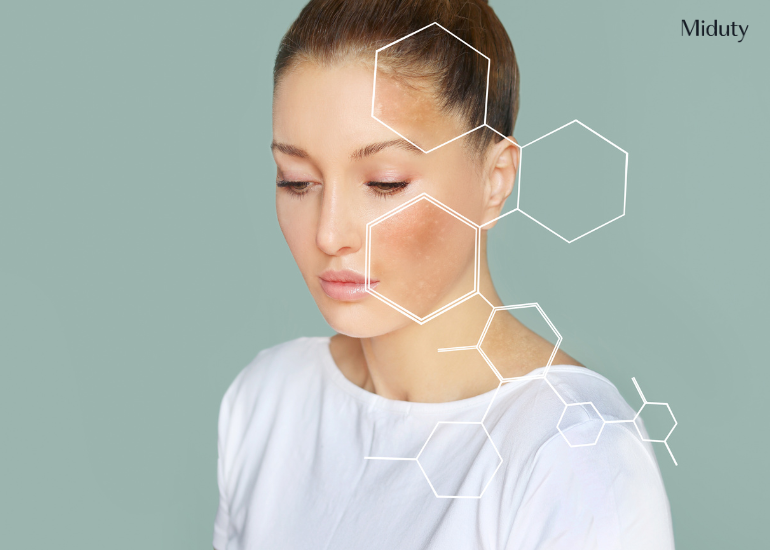 What is Melasma: Types, Causes, Symptoms, and Treatment Options