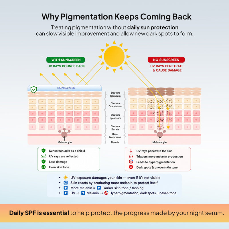 SHowing Why pigmentation keeps coming back