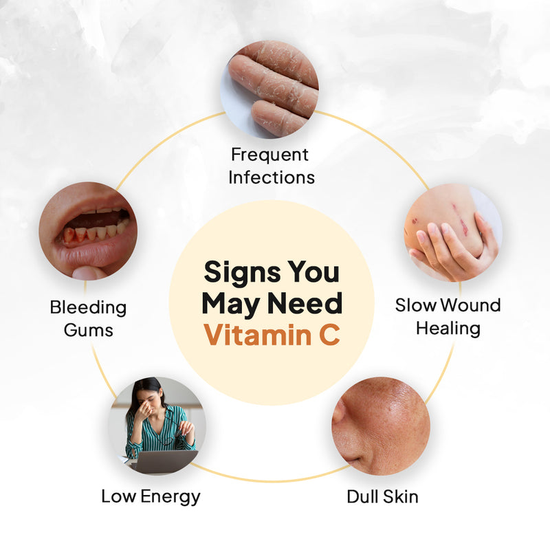 Liposomal Vitamin C